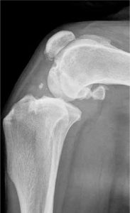 makiandampars - dog osteoarthritis
